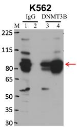 DNMT3B Antibody in RNA Immunoprecipitation (RIP)