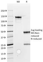 ROR2 Antibody in SDS-PAGE (SDS-PAGE)