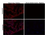 Podoplanin Antibody in Immunohistochemistry (Paraffin) (IHC (P))