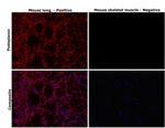 Podoplanin Antibody in Immunohistochemistry (Paraffin) (IHC (P))