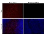 CD4 Antibody in Immunohistochemistry (Paraffin) (IHC (P))