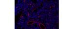 Cutaneous Lymphocyte Antigen (CLA) Antibody in Immunohistochemistry (Paraffin) (IHC (P))