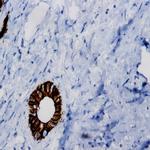 FGFR-3 Antibody in Immunohistochemistry (PFA fixed) (IHC (PFA))