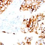 Claudin 7 Antibody in Immunohistochemistry (Paraffin) (IHC (P))