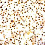 Phospho-NFkB-p100/p52 (Ser870) Antibody in Immunocytochemistry (ICC/IF)