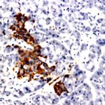 MMP-1 (Collagenase-I) Antibody in Immunohistochemistry (Paraffin) (IHC (P))