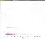 IL-10 Antibody in Western Blot (WB)