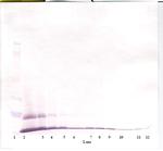 Eotaxin Antibody in Western Blot (WB)