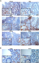 CCR6 Antibody in Immunohistochemistry (IHC)