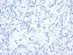 PAX2 (Renal Cell and Ovarian Carcinoma Marker) Antibody in Immunohistochemistry (Paraffin) (IHC (P))