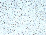 PAX2 (Renal Cell and Ovarian Carcinoma Marker) Antibody in Immunohistochemistry (Paraffin) (IHC (P))