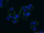 ABCB6 Antibody in Immunocytochemistry (ICC/IF)