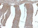 SPTLC2 Antibody in Immunohistochemistry (Paraffin) (IHC (P))