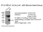 UBC9 Antibody in Immunoprecipitation (IP)