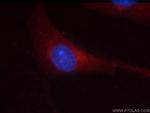 GSK3B Antibody in Immunocytochemistry (ICC/IF)