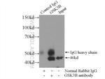 GSK3B Antibody in Immunoprecipitation (IP)