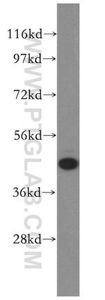 GSK3B Antibody in Western Blot (WB)