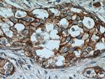 beta-Catenin Antibody in Immunohistochemistry (Paraffin) (IHC (P))