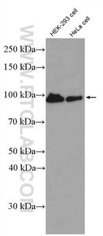 beta-Catenin Antibody in Western Blot (WB)