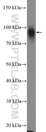 beta-Catenin Antibody in Western Blot (WB)