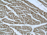 SMAD4 Antibody in Immunohistochemistry (Paraffin) (IHC (P))