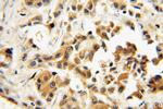 SMAD4 Antibody in Immunohistochemistry (Paraffin) (IHC (P))