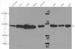 SMAD4 Antibody in Western Blot (WB)