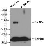 SMAD4 Antibody in Western Blot (WB)