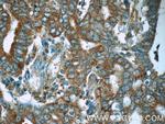 MEK1 Antibody in Immunohistochemistry (Paraffin) (IHC (P))