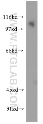 PPP1R13L Antibody in Western Blot (WB)