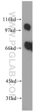 PPP1R13L Antibody in Western Blot (WB)