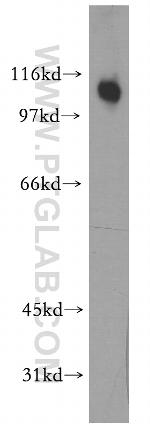 PPP1R13L Antibody in Western Blot (WB)