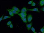 HYAL2 Antibody in Immunocytochemistry (ICC/IF)