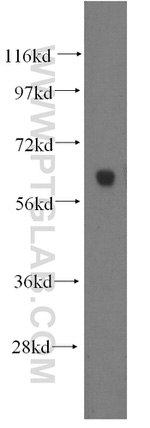 HYAL2 Antibody in Western Blot (WB)