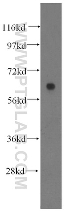 HYAL2 Antibody in Western Blot (WB)