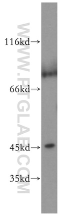 JNK Antibody in Western Blot (WB)