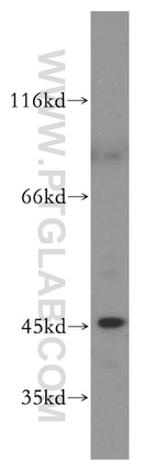 JNK Antibody in Western Blot (WB)