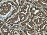 JNK Antibody in Immunohistochemistry (Paraffin) (IHC (P))