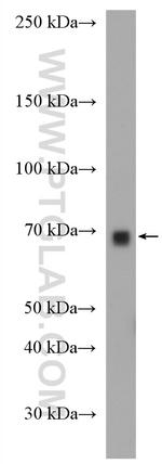 Cyp4a12a Antibody in Western Blot (WB)