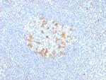 PDCD1/PD1/CD279 (Programmed Cell Death 1) Antibody in Immunohistochemistry (Paraffin) (IHC (P))