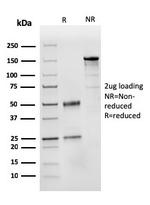 CD31/PECAM-1 Antibody in SDS-PAGE (SDS-PAGE)