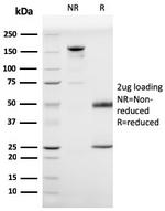 Prohibitin (Mitochondrial Marker) Antibody in SDS-PAGE (SDS-PAGE)