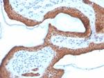 SERPINB5/Maspin Antibody in Immunohistochemistry (Paraffin) (IHC (P))