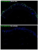 Pan Cytokeratin Antibody in Immunohistochemistry (Paraffin) (IHC (P))