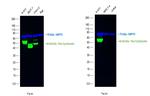 Pan Cytokeratin Antibody