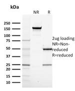 RNA Polymerase II Antibody in SDS-PAGE (SDS-PAGE)