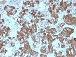 ACTH (Adrenocorticotrophic Hormone) (Pituitary Marker) Antibody in Immunohistochemistry (Paraffin) (IHC (P))