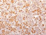 ACTH (Adrenocorticotrophic Hormone) (Pituitary Marker) Antibody in Immunohistochemistry (Paraffin) (IHC (P))