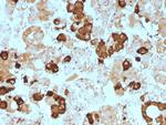 ACTH (Adrenocorticotrophic Hormone) (Pituitary Marker) Antibody in Immunohistochemistry (Paraffin) (IHC (P))