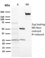 ACTH (Adrenocorticotrophic Hormone) (Pituitary Marker) Antibody in SDS-PAGE (SDS-PAGE)